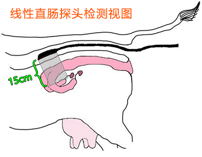 兽用B超机线阵直肠探头