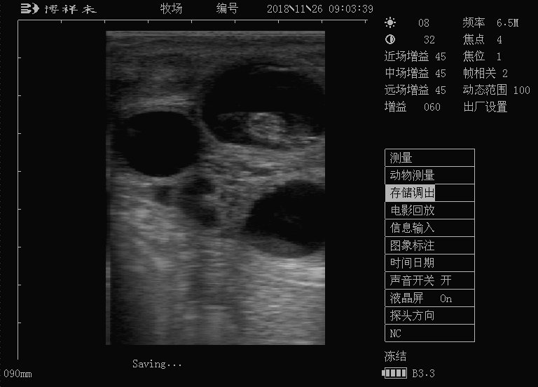 线性直肠探头超声图像